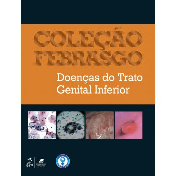 Coleção Febrasgo - Doenças Do Trato Genital Inferior