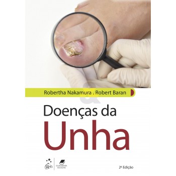 Doenças Da Unha: Do Diagnóstico Ao Tratamento