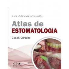 Atlas De Estomatologia: Casos Clínicos