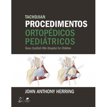 Tachdjian Procedimentos Ortopédicos Pediátricos