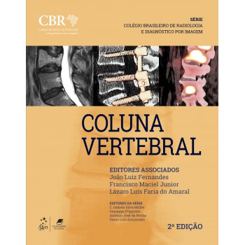 Cbr - Coluna Vertebral