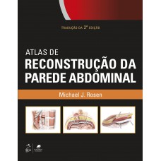 Atlas De Reconstrução Da Parede Abdominal