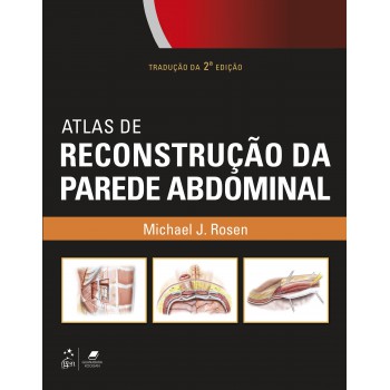 Atlas De Reconstrução Da Parede Abdominal