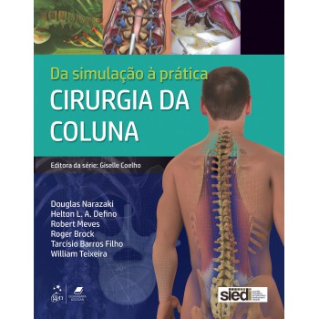 Cirurgia Da Coluna