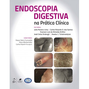 Endoscopia Digestiva Na Prática Clínica