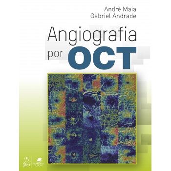 Angiografia Por Oct