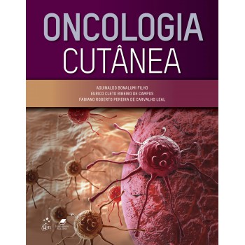 Oncologia Cutânea