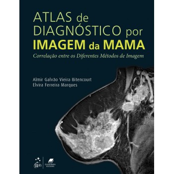 Atlas De Diagnóstico Por Imagem De Mama