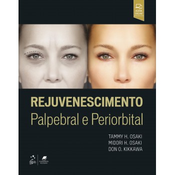 Rejuvenescimento Palpebral E Periorbital