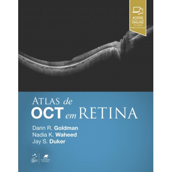 Atlas De Oct Em Retina