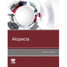 Alopecia