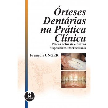 órteses Dentárias Na Prática Clínica: Placas Oclusais E Outros Dispositivos Interoclusais