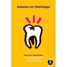 Implantes Em Odontologia