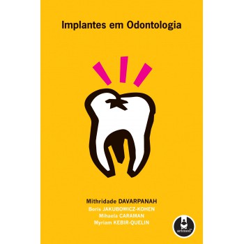 Implantes Em Odontologia