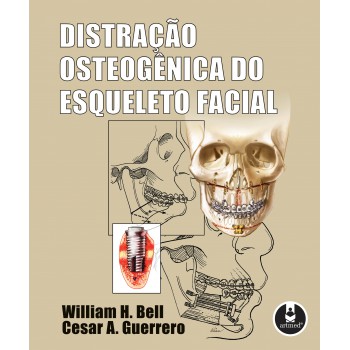 Distração Osteogênica Do Esqueleto Facial