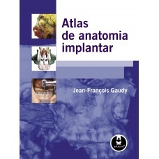 Atlas De Anatomia Implantar