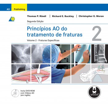 Princípios Ao Do Tratamento De Fraturas