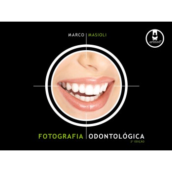 Fotografia Odontológica