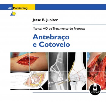 Manual Ao De Tratamento De Fraturas: Antebraço E Cotovelo