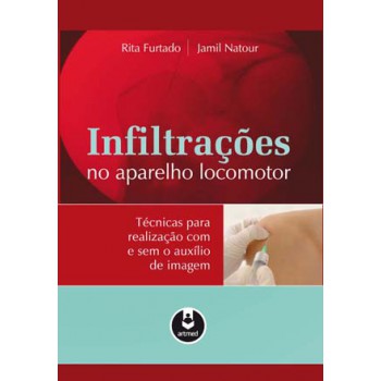 Infiltrações Do Aparelho Locomotor: Técnicas Para Realização Com E Sem O Auxílio De Imagem