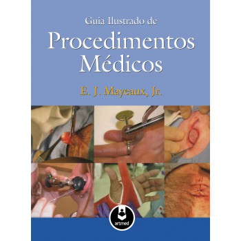 Guia Ilustrado De Procedimentos Médicos