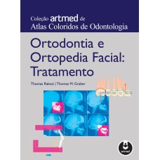 Ortodontia E Ortopedia Facial: Tratamento