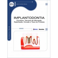 Implantodontia: Princípios, Técnicas De Fabricação, Reabilitação, Oclusão E Tipos De Próteses