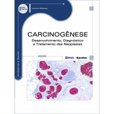 Carcinogênese: Desenvolvimento, Diagnóstico E Tratamento Das Neoplasias