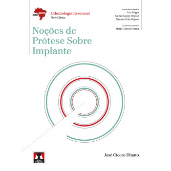 Noções De Prótese Sobre Implante