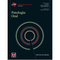 Patologia Oral