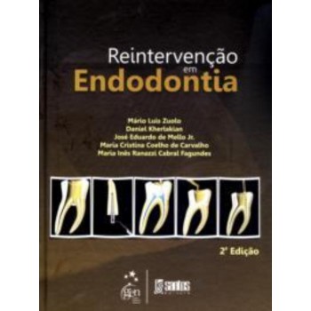 Reintervenção em Endodontia