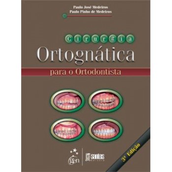 Cirurgia Ortognática Para O Ortodontista