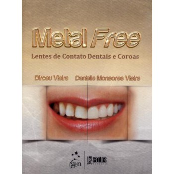 Metal Free - Lentes de Contato Dentais e Coroas