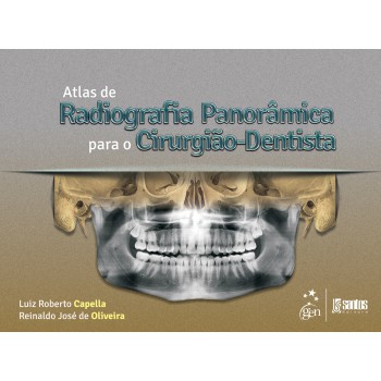 Atlas De Radiografia Panorâmica Para O Cirurgião-dentista