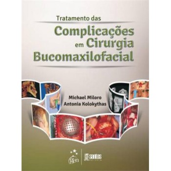 Tratamento Das Complicações Em Cirurgia Bucomaxilofacial