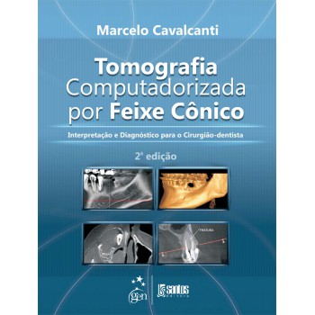 Tomografia Computadorizada por Feixe Cônico - Interpretação e Diagnóstico para o Cirurgião-Dentista