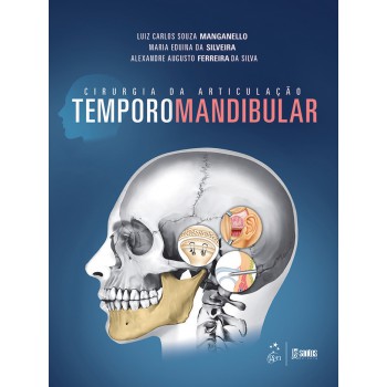 Cirurgia Da Articulação Temporomandibular