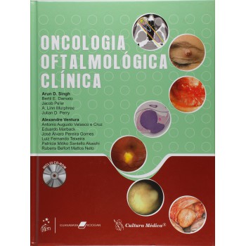 Oncologia Oftalmológica Clínica