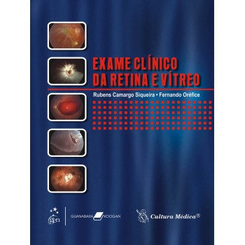 Exame Clínico Da Retina E Vítreo