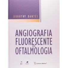 Angiografia Fluorescente Em Oftalmologia