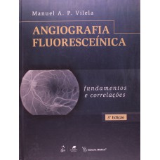 Angiografia Fluoresceínica - Fundamentos E Correlações