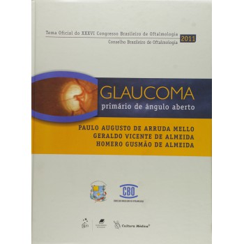 Glaucoma Primário De ângulo Aberto