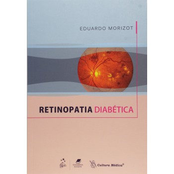 Retinopatia Diabética