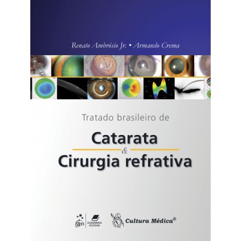 Tratado Brasileiro De Catarata E Cirurgia Refrativa