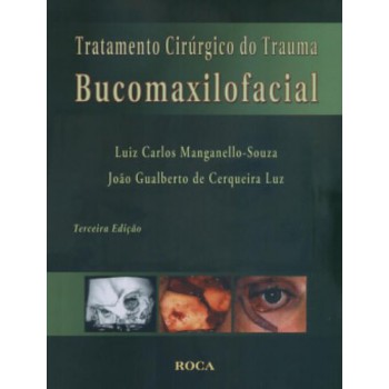 Tratamento Cirúrgico Do Trauma Bucomaxilofacial