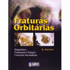 Fraturas Orbitárias: Diag.Trat.Cirur. Correc. Secund.