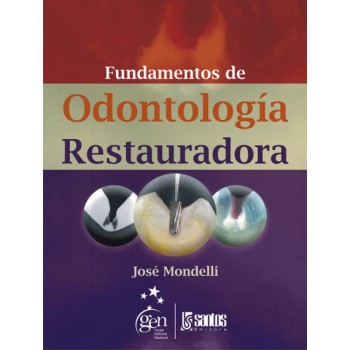 Fundamentos De Odontología Restauradora
