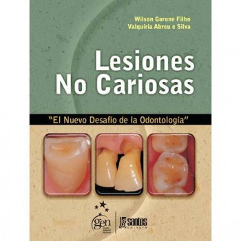 Lesiones no Cariosas - El Nuevo Desafío de la OdontologÍa