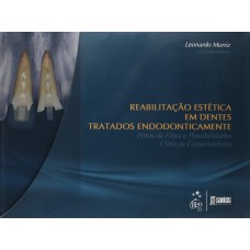 Reab.Estética Dentes Tratados Endodonticamente-Pinos de Fibra Possibilidades Clínicas Conservadoras