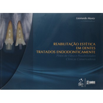 Reab.Estética Dentes Tratados Endodonticamente-Pinos de Fibra Possibilidades Clínicas Conservadoras